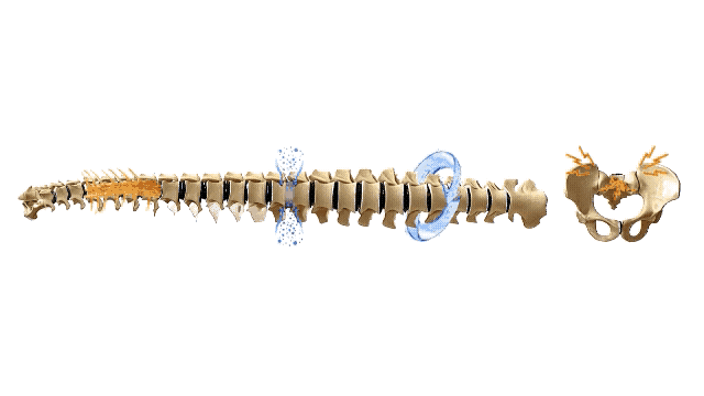 Spinal Decompression