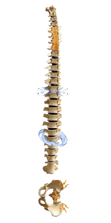 Spinal Decompression