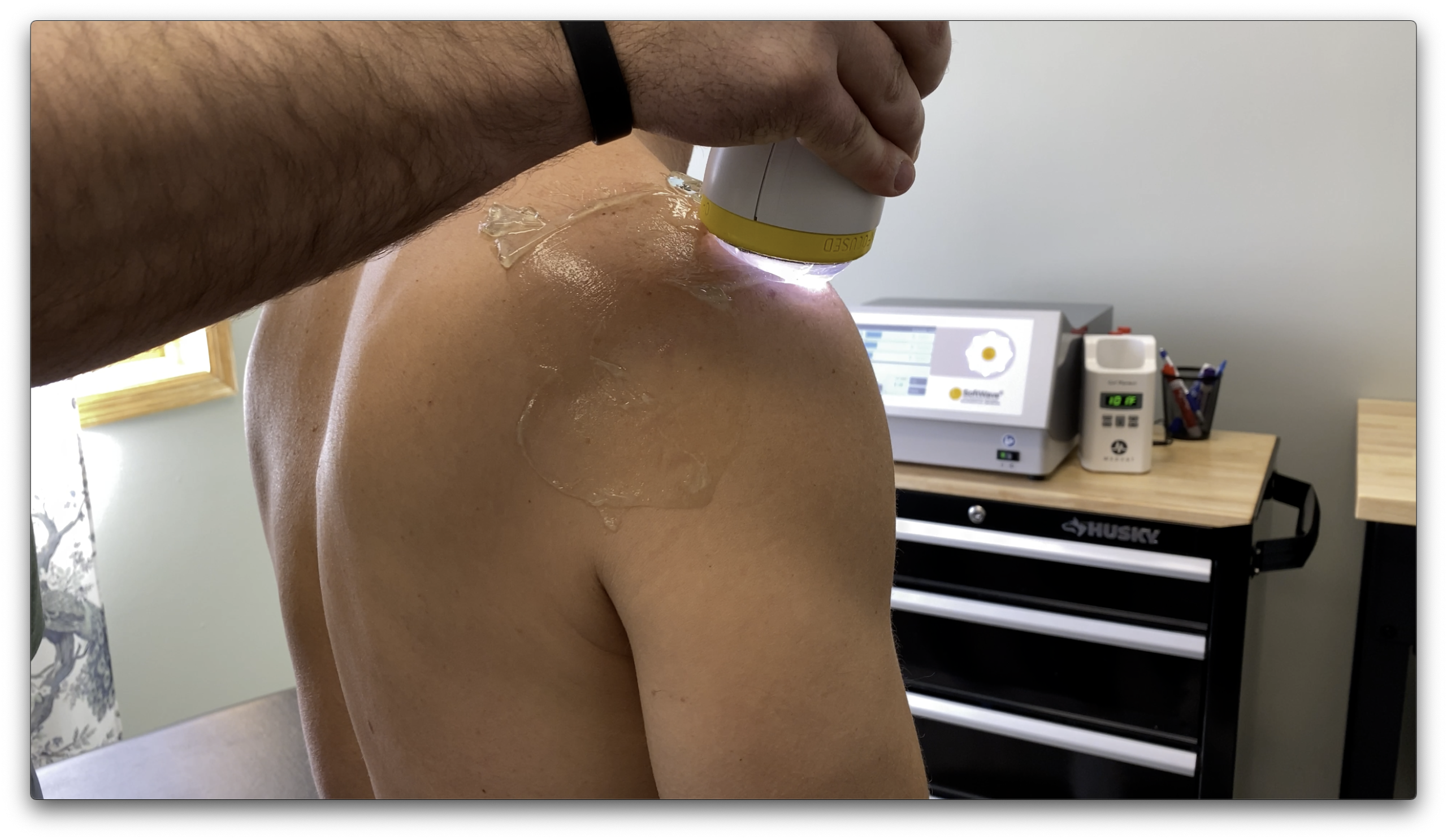 SoftWave TRT